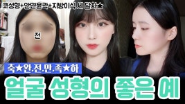 (코, 안면윤곽, 지방이식) 효과 대만족! 자연스럽게 예뻐지고 싶어? - kakaoTV (코, 안면윤곽, 지방이식) 효과 대만족! 자연스럽게 예뻐지고 싶어?