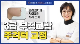 [강남교정치과 - 오리건치과] - kakaoTV 주걱턱 3급 부정교합 - 치아교정으로 어떤 변화가!? [강남교정치과 - 오리건치과]