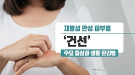 재발성 만성 피부병 ‘건선’ 주요 증상과 생활 관리법 - kakaoTV 재발성 만성 피부병 ‘건선’  주요 증상과 생활 관리법 