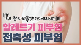 알레르기 피부염과 접촉성 피부염 피부를 관리하는 방법 (ft.이것만은 안됩니다) - kakaoTV 알레르기 피부염과 접촉성 피부염 피부를 관리하는... 