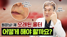 PD의 흉터 치료 상담😎 | 원장님~ 제 오랜된 흉터는 어떻게 해야 될까요 😭 (성형외과 전문의 답변❕) - kakaoTV PD의 흉터 치료 상담... 