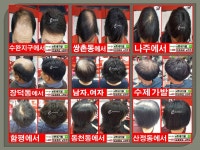 광주가발 전문점 여자 남자 수제가발 - kakaoTV 광주가발 전문점 여자 남자 수제가발 