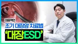 대표적인 조기 대장암 치료법 대장ESD (세강병원 김찬호 원장) - kakaoTV  대표적인 조기 대장암 치료법 대장ESD (세강병원 김찬호 원장)