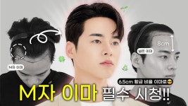 전정아헤어라인 | | 남자 헤어라인의 중요성 | 비절개 모발이식 1년 차 후기 - kakaoTV 이마만 채웠을 뿐인데 100배 잘생겨짐. | 남자 헤어라인의 중요성 | 비절개...