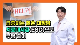 급증하는 젊은 대장암, 치료내시경(ESD)으로 부담 줄어 (세강병원... 젊은 대장암, 치료내시경(ESD)으로 부담 줄어 (세강병원 김찬호 원장)