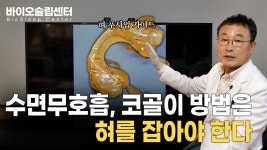 수면무호흡 코골이 방법은 혀를 잡아야한다 - kakaoTV 수면무호흡 코골이 방법은 혀를 잡아야한다