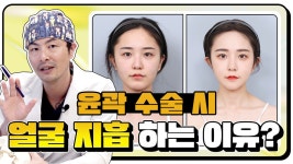 l 윤곽3종, 얼굴 지흡 후기 l 디에이성형외과 - kakaoTV 윤곽 수술 시... 얼굴 지방흡입 하는 이유는? l 윤곽3종, 얼굴 지흡 후기 l 디에이성형외과