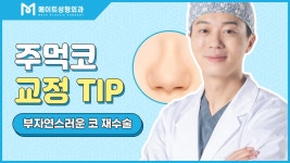[메이트성형외과] 코재수술 실패도 메이트에서 해결! - kakaoTV [메이트성형외과] 코재수술 실패도 메이트에서 해결!