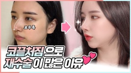 l 귀연골, 비중격 연골자가연골 채취가 어렵다면 l 디에이성형외과... l 귀연골, 비중격 연골자가연골 채취가 어렵다면 l 디에이성형외과