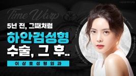 어떻게 달라졌을까?ㅣ수원성형외과 추천 이상호성형외과 - kakaoTV 하안검수술 전후 사례 ! 어떻게 달라졌을까?ㅣ수원성형외과 추천... 