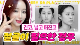 l 긴 코성형, 넓고 퍼진 코 얄쌍하게 하려면 l 디에이성형외과 - kakaoTV... l 긴 코성형, 넓고 퍼진 코 얄쌍하게 하려면 l 디에이성형외과