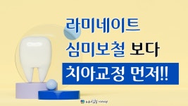 라미네이트 심미보철 보다 치아교정 먼저!![부산 서면 센텀 남포 - 뉴욕스마일치과의원] - kakaoTV 라미네이트 심미보철 보다 치아교정 먼저!!... 