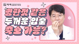 #인천성형외과 - 명란젓 같은 두꺼운 입술 축소 가능? (#인천구월동성형외과 윤희근) - kakaoTV #인천성형외과 - 명란젓 같은 두꺼운 입술 축소... 