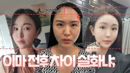 이마가 이렇게 중요합니다..😮 #이마거상 #이마축소 - kakaoTV 티 안나게 청순세련 분위기 장착하는 법?! 이마가 이렇게 중요합니다..... 
