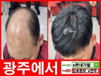 광주가발 김호증모 추천 전문점 - kakaoTV 광주가발 김호증모 추천 전문점 