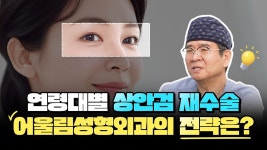 [대전 어울림성형외과] 상안검 재수술, 왜 나이에 따라 방법이 달라질까? - kakaoTV [대전 어울림성형외과] 상안검 재수술, 왜 나이에 따라... 