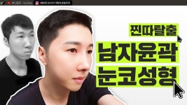 l 디에이성형외과 - kakaoTV 중안부 짧아지는법, 남자 윤곽수술, 코성형, 이마축소 l 하남자 갱생 메이크 오버 l 디에이성형외과