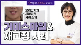 거미스마일 & 치아재교정 사례 소개 [강남치아교정치과 - 오리건치과] - kakaoTV 거미스마일 & 치아재교정 사례 소개 [강남치아교정치과... 