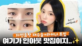 원래도 예뻤지만 더 예뻐진 인아웃 맛집🍑ㅣ자연유착재수술&라이너트임 - kakaoTV 원래도 예뻤지만 더 예뻐진 인아웃 맛집... 