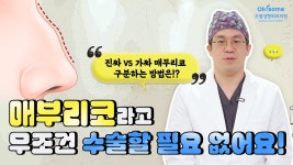 【오썸성형외과】 - kakaoTV 매부리코라고 무조건 수술할 필요 없어요! 진성vs가성 매부리코 구분 방법은? 【오썸성형외과】