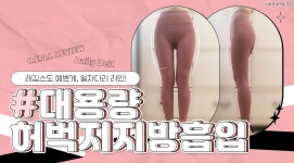 대용량😍허벅지지방흡입 리얼후기! 압구정탑라인의원💜 - kakaoTV 대용량😍허벅지지방흡입 리얼후기! 압구정탑라인의원💜