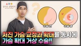 교정과 확대수술을 동시에?! | 삼사오성형외과 - kakaoTV 가슴거상수술✨처진가슴 교정과 확대수술을 동시에?! | 삼사오성형외과