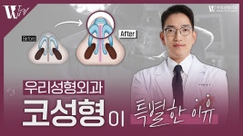 우리성형외과 코성형이 특별한 이유✨ - kakaoTV 우리성형외과 코성형이 특별한 이유✨