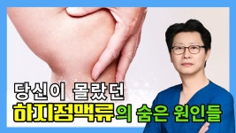 당신이 몰랐던 하지정맥류의 숨은 원인들 (전정욱 푸른맥외과 수원점 원장) - kakaoTV 당신이 몰랐던 하지정맥류의 숨은 원인들 (전정욱... 