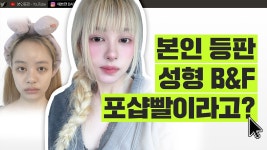 가장 만족스러운 성형 부위는 ㅣ 디에이성형외과 ㅣ 디에이성형외과의원 - kakaoTV 이마축소부터 윤곽성형까지! 가장 만족스러운 성형 부위는 ㅣ... 