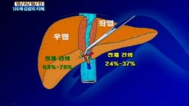 백세건강시대 59회 무료보기-SBS ALL VOD 59회 백세건강시대 : All VOD