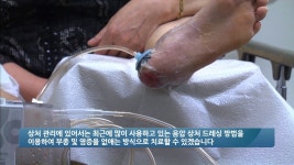 닥터Q 내 몸을 말하다 119회 무료보기-SBS ALL VOD 119회 닥터Q 내 몸을 말하다 : All VOD