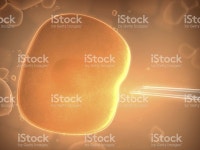 인공수정 스톡 사진 172741396 | iStock Artificial Insemination