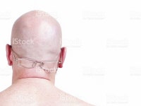 볼드 남자 머리 안경 스톡 사진 92944927 | iStock bald man head with glasses