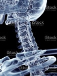 이 자궁경관 척추 스톡 사진 482241874 | iStock accurate medical illustration of the cervical spine