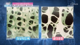 굿모닝 정보세상 명장면 상세 굿모닝 정보세상 11회 - 뼈 건강을 지키려면 ‘체중조절’은 필수!
