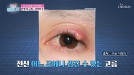 굿모닝 정보세상 명장면 상세 굿모닝 정보세상 93회 - 고단백 저지방이라 성인병 걱정 NO ‘흑염소’