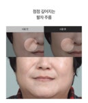 [콤마나인]비건인증 유스 콜라겐 팔자,미간주름패치 1박스 (12패치x5매) [W CONCEPT]