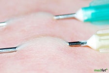 Flipboard의 MedFetUK