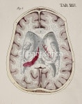 해외작가포토 - 클립아트코리아 :: 통로이미지(주) __적합한콘텐츠,과학,그리기,뇌,머리,생물학,신체,역사,연속,일러스트,자연과학,작품,프랑스어... 