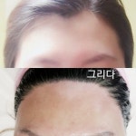 헤어라인교정 왁싱 | 안전한 중고나라, NO.1 직거래 번개장터 헤어라인교정 왁싱 | 번개장터