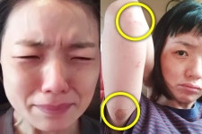 안영미건강 | 검색결과 - zum 허브