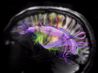 Why exercise helps with stress - Business Insider Neuroscientists may have figured out exactly how working out reduces stress