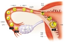 대리모의 인권 :이 아(兒)는 누구 아(兒) 요?