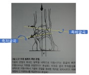 걷기의 재해석 : 발목 관절의 움직임