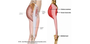 대퇴근막장근(Tensor fascia lata)
