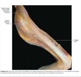 대퇴근막장근(Tensor fascia lata)