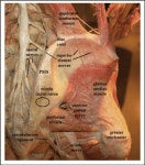 대퇴근막장근(Tensor fascia lata)