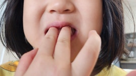 이가 아파요