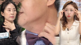 하루 5분 투자! 눈가 주름·목주름 예방 위한 지압! (닥터필생기) - kakaoTV 하루 5분 투자! 눈가 주름·목주름 예방 위한 지압! (닥터필생기)