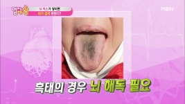 뇌에 독소가 쌓이면 ＜흑태＞가 나타난다? - kakaoTV 뇌에 독소가 쌓이면 ＜흑태＞가 나타난다?